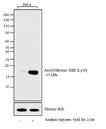 H2BK5ac Antibody