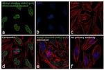 H2BK5ac Antibody in Immunocytochemistry (ICC/IF)