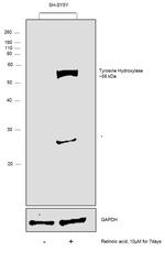 Tyrosine Hydroxylase Antibody in Western Blot (WB)