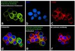 Tyrosine Hydroxylase Antibody in Immunocytochemistry (ICC/IF)