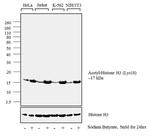 H3K18ac Antibody in Western Blot (WB)