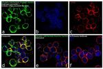 Phospho-ZAP70/Syk (Tyr319, Tyr352) Antibody in Immunocytochemistry (ICC/IF)