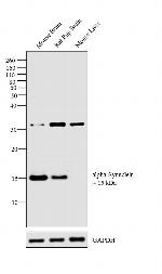 alpha Synuclein Antibody in Western Blot (WB)