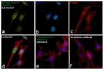 Phospho-STAT3 (Ser727) Antibody in Immunocytochemistry (ICC/IF)