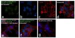 Phospho-p70 S6 Kinase (Thr421, Ser424) Antibody