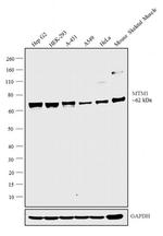 MTM1 Antibody in Western Blot (WB)