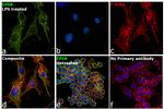 EPS8 Antibody in Immunocytochemistry (ICC/IF)