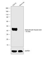 Alpha-Smooth Muscle Actin Antibody