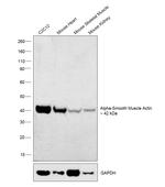 Alpha-Smooth Muscle Actin Antibody in Western Blot (WB)