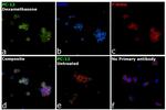 Tyrosine Hydroxylase Antibody