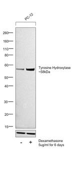 Tyrosine Hydroxylase Antibody in Western Blot (WB)