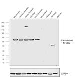 Cannabinoid Receptor 1 Antibody in Western Blot (WB)