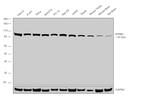 KPNB1 Antibody in Western Blot (WB)