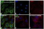 ATGL Antibody in Immunocytochemistry (ICC/IF)