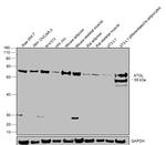 ATGL Antibody in Western Blot (WB)