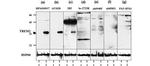 TREM2 Antibody in Western Blot (WB)