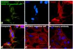 B1 Bradykinin Receptor Antibody