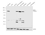 NEFM Antibody in Western Blot (WB)