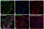 NEFM Antibody in Immunocytochemistry (ICC/IF)