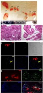 Ki-67 Antibody in Immunohistochemistry (IHC)