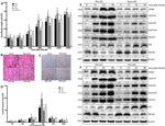 Ki-67 Antibody in Immunohistochemistry (IHC)