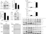 Ki-67 Antibody in Immunohistochemistry (IHC)