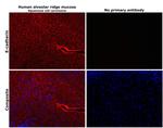 E-cadherin Antibody in Immunohistochemistry (Paraffin) (IHC (P))