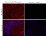 E-cadherin Antibody in Immunohistochemistry (Paraffin) (IHC (P))