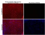 E-cadherin Antibody in Immunohistochemistry (Paraffin) (IHC (P))