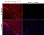 E-cadherin Antibody in Immunohistochemistry (Paraffin) (IHC (P))