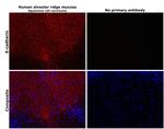 E-cadherin Antibody in Immunohistochemistry (Paraffin) (IHC (P))