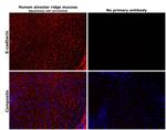 E-cadherin Antibody in Immunohistochemistry (Paraffin) (IHC (P))