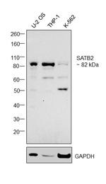 SATB2 Antibody in Western Blot (WB)