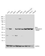 beta Dystroglycan Antibody in Western Blot (WB)