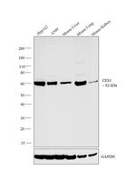 CES1 Antibody in Western Blot (WB)