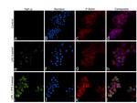 TNF alpha Antibody in Immunocytochemistry (ICC/IF)