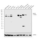 BACE1 Antibody in Western Blot (WB)