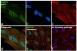 BNIP3L Antibody in Immunocytochemistry (ICC/IF)