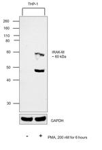 IRAK-M Antibody in Western Blot (WB)