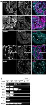 Blimp-1 Antibody in Immunohistochemistry (IHC)