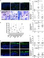 TSLP Antibody in Immunohistochemistry (IHC)