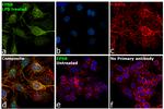 EPS8 Antibody in Immunocytochemistry (ICC/IF)