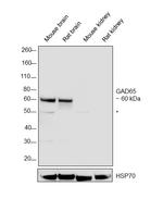 GAD65 Antibody in Western Blot (WB)