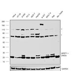 HPRT1 Antibody in Western Blot (WB)