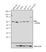 GBA Antibody in Western Blot (WB)