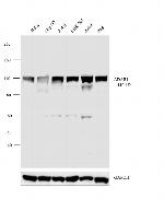 ADAR1 Antibody in Western Blot (WB)