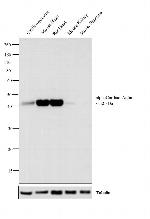 alpha-Cardiac Actin Antibody