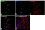 NUP62 Antibody in Immunocytochemistry (ICC/IF)