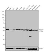 SUCLG2 Antibody in Western Blot (WB)