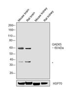 GAD65 Antibody in Western Blot (WB)